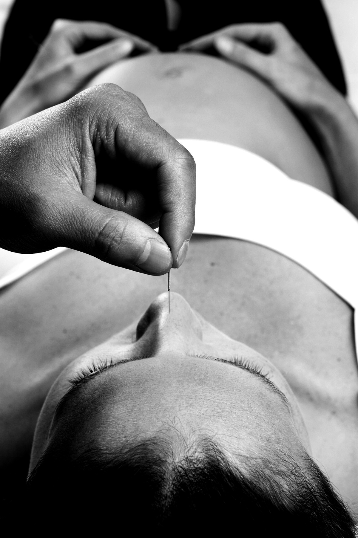 Εγκυμοσύνη βελονισμός