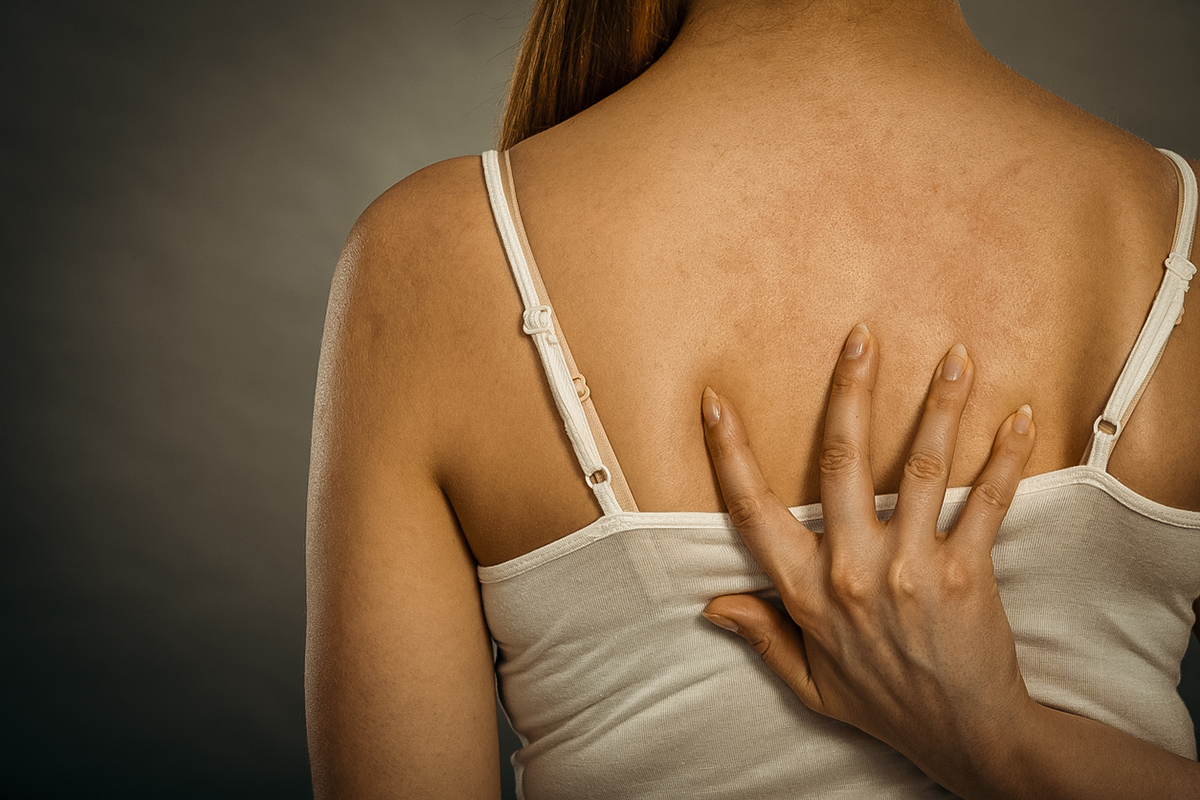 δερματικές ατέλειες