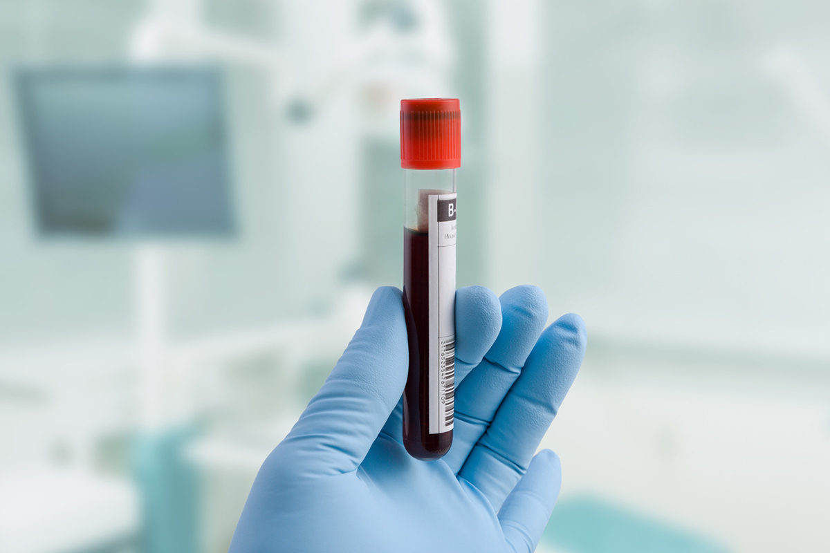 Η έκβαση της λοίμωξης COVID-19 μπορεί να εξαρτάται από το αίμα μας