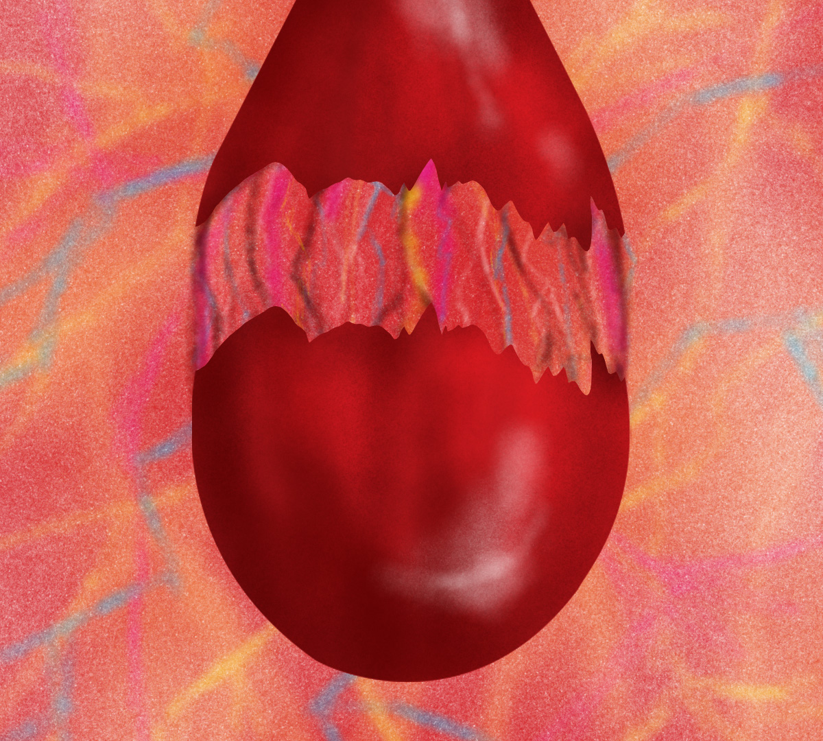 θαλασσαιμία