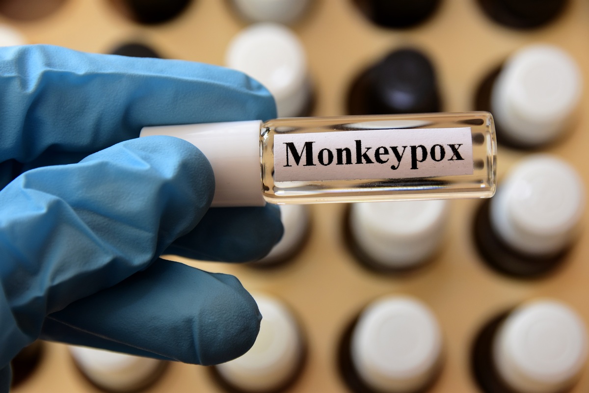 ευλογιά των πιθήκων