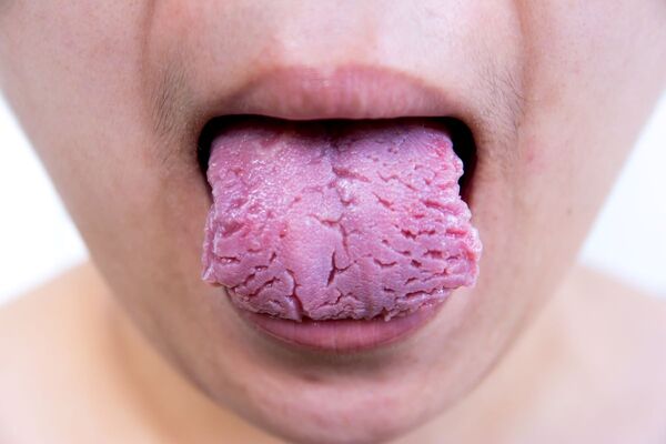 Sjogren