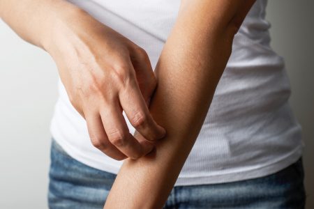 Ατοπική δερματίτιδα: 7 συνήθειες που την επιδεινώνουν