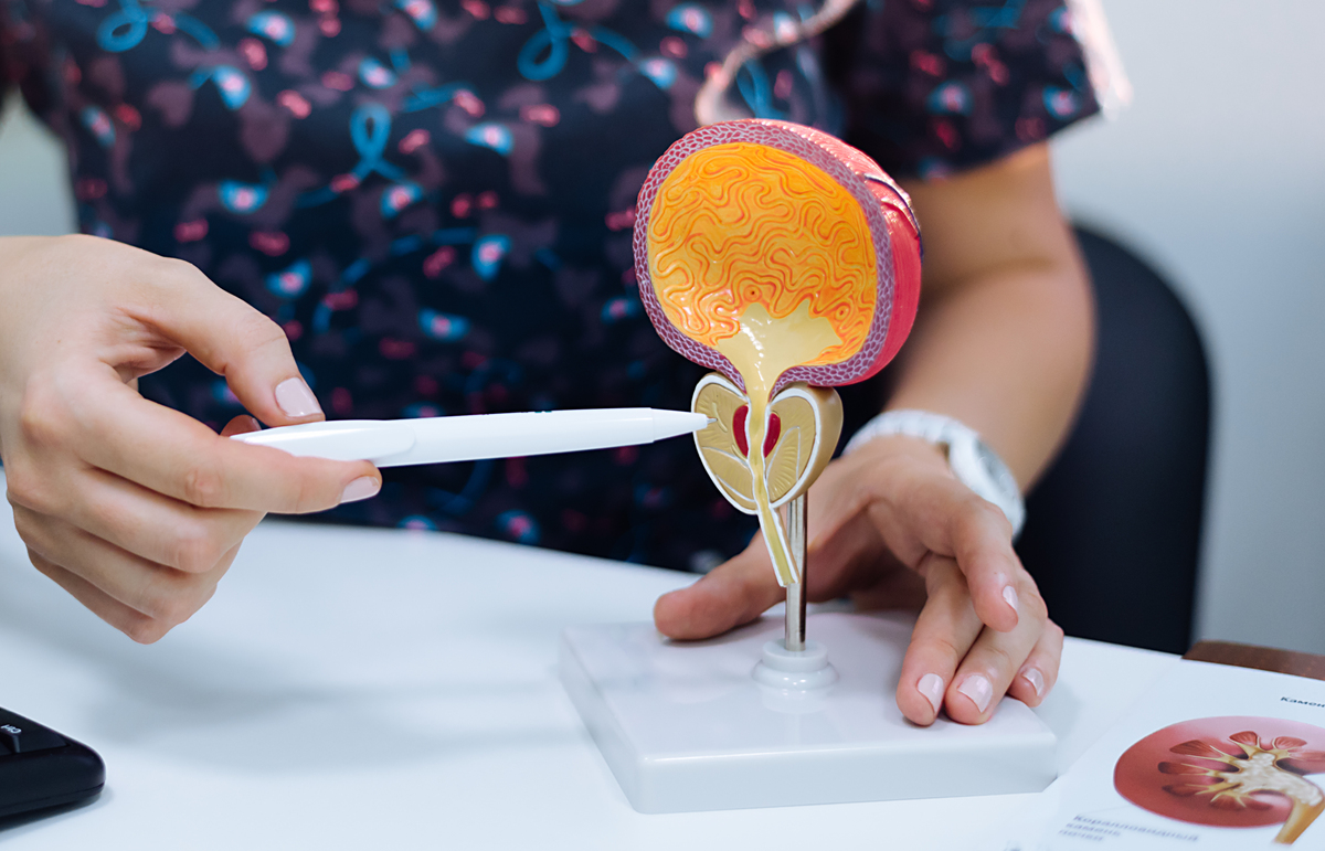 καρκίνος προστάτη