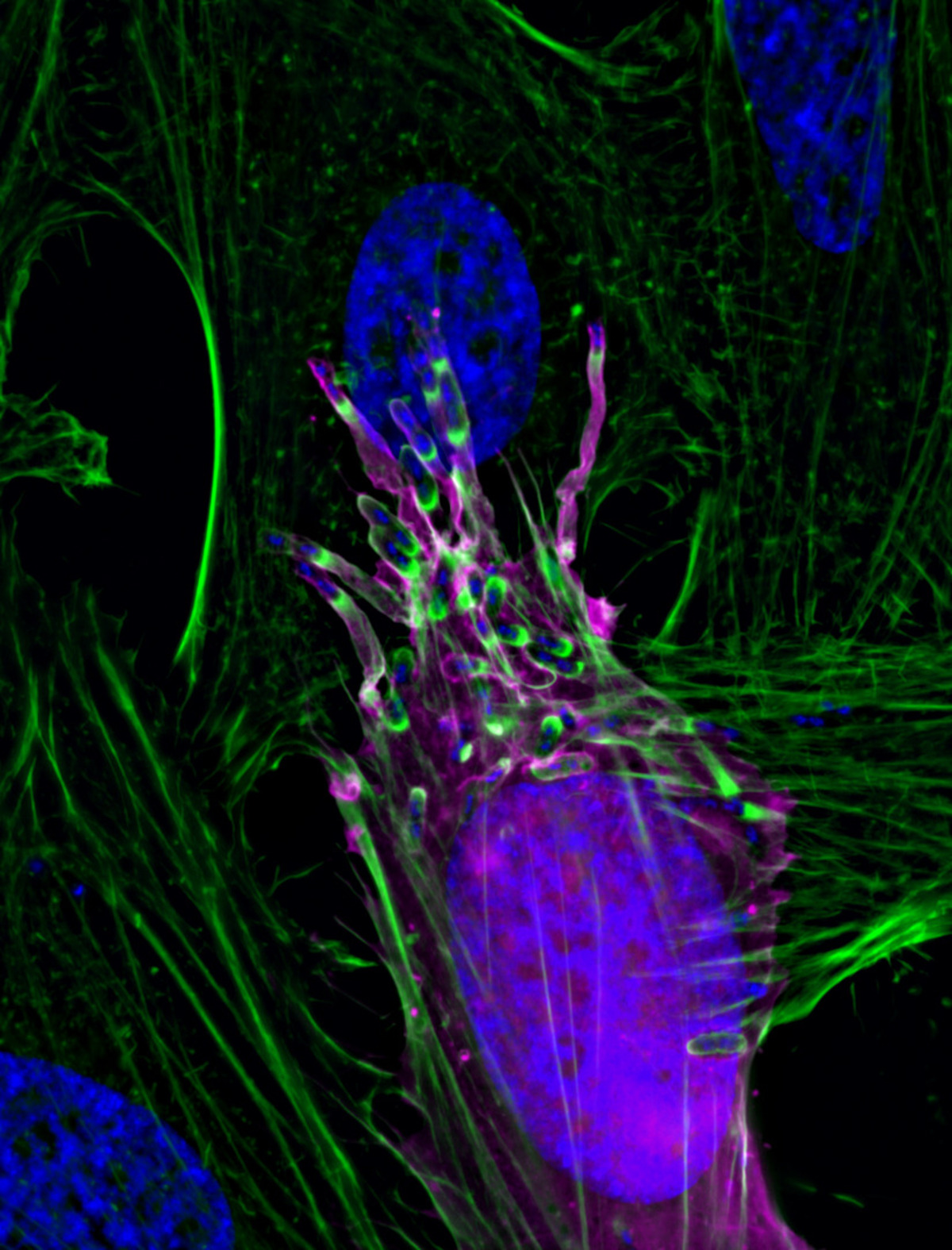 μικροσκόπιο