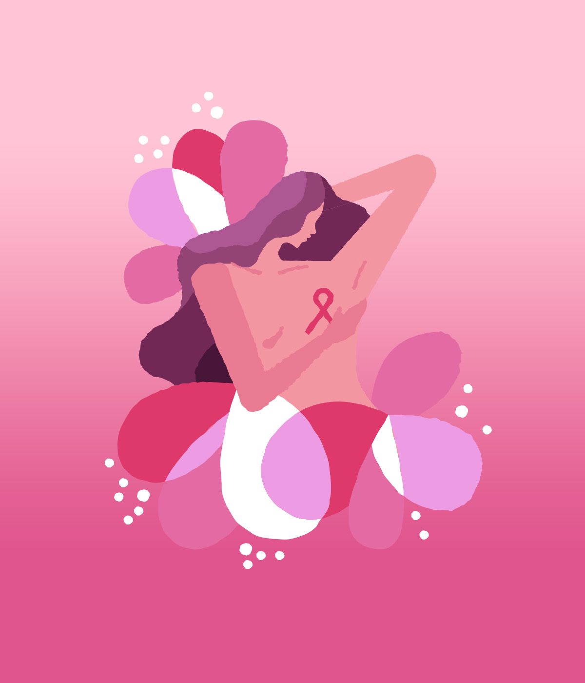 καρκίνος μαστού