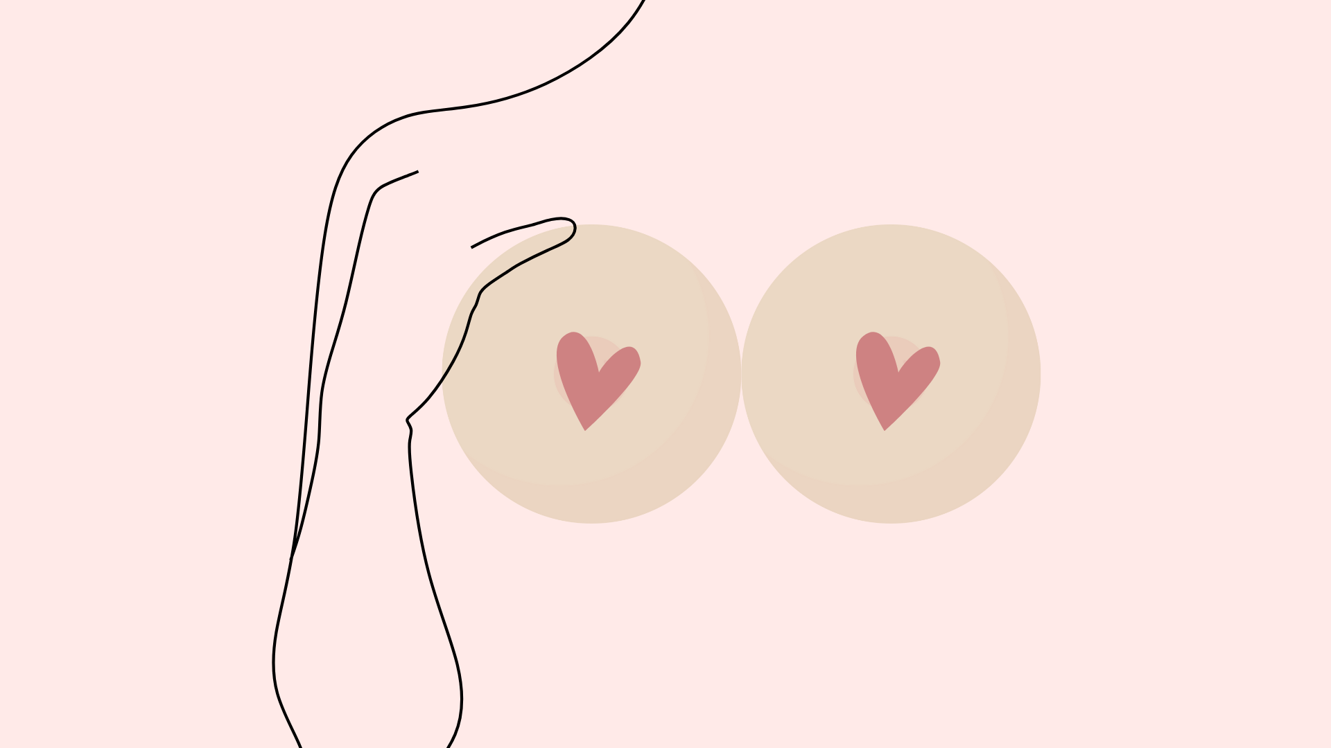 αυτοεξέταση στήθους