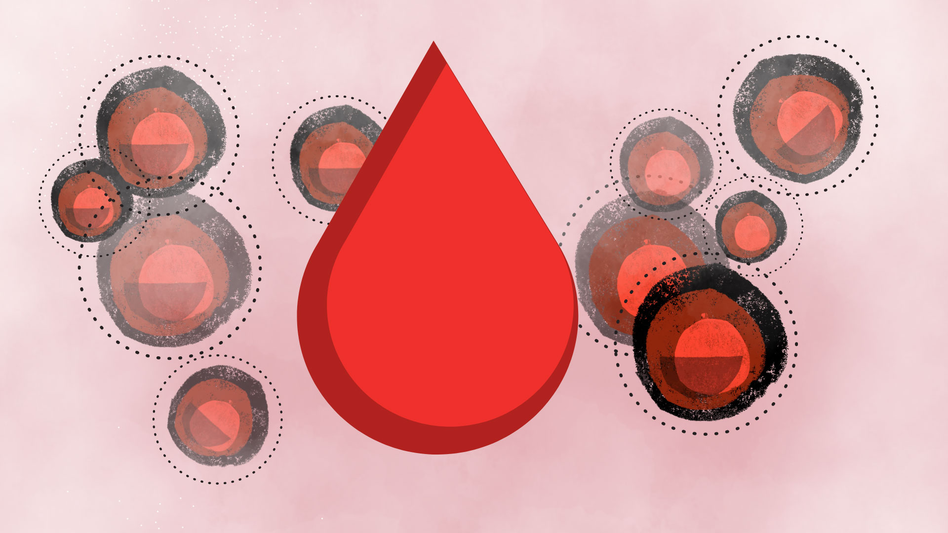 Αντίσταση στην ινσουλίνη