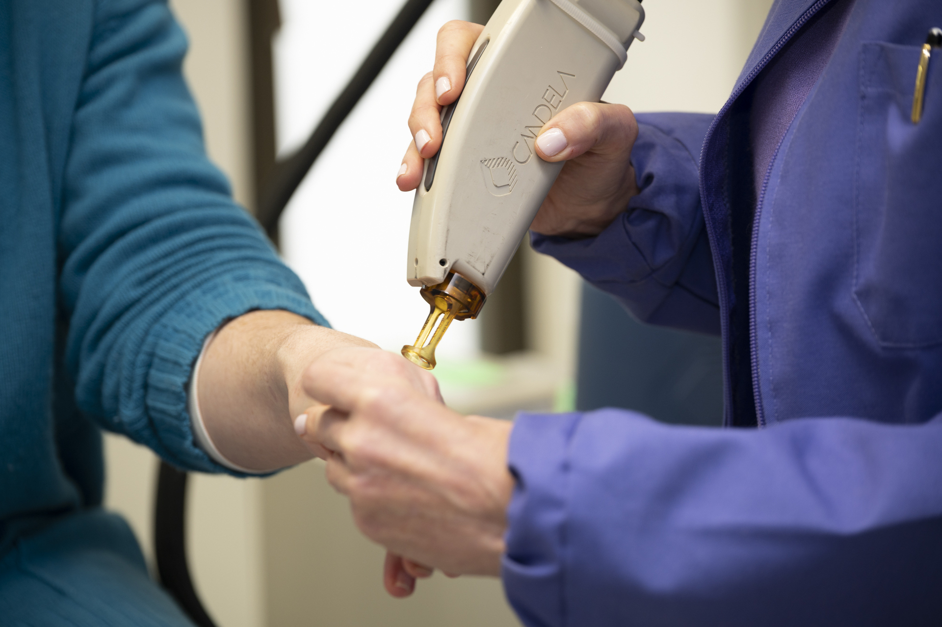 Πώς έσβησα τις κηλίδες από τα χέρια μου