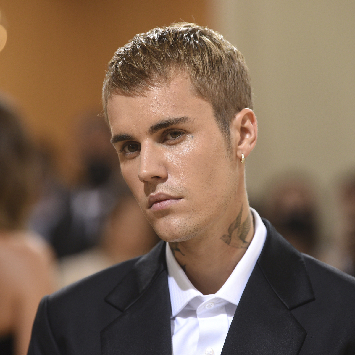 5 celebrities απενεχοποιούν τα δερματικά τους προβλήματα