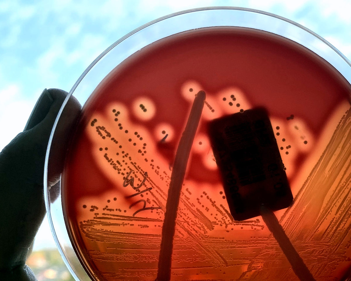 στρεπτόκοκκος