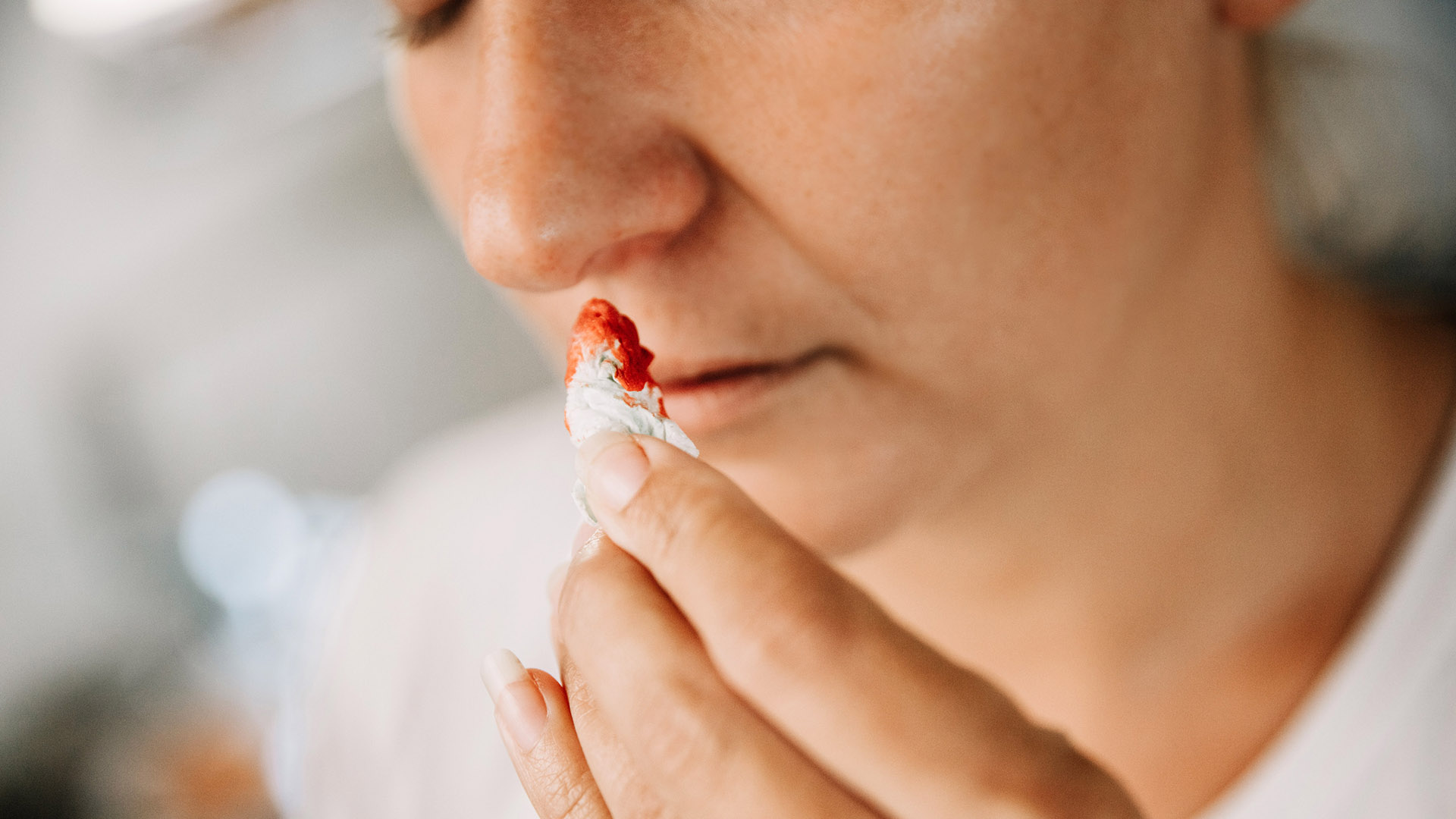 ρινορραγία