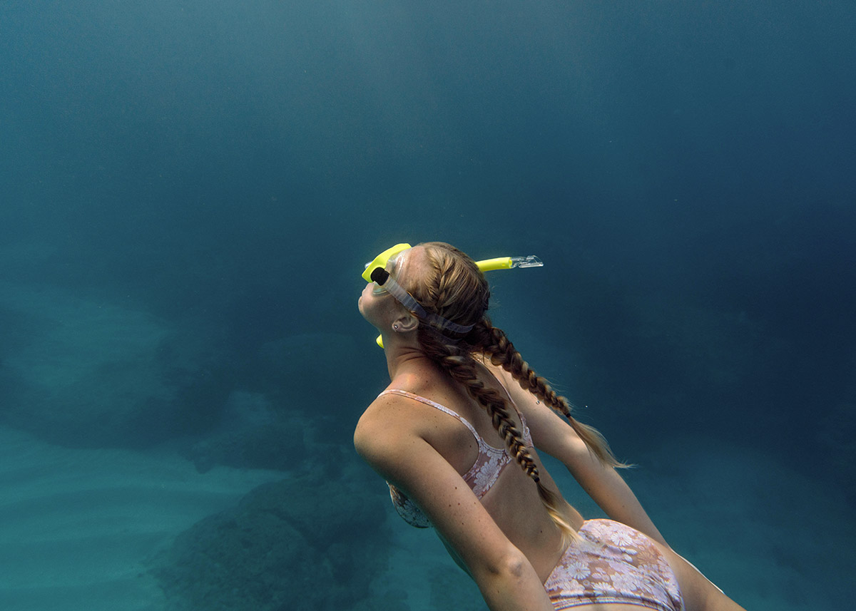 Εξωτερική ωτίτιδα