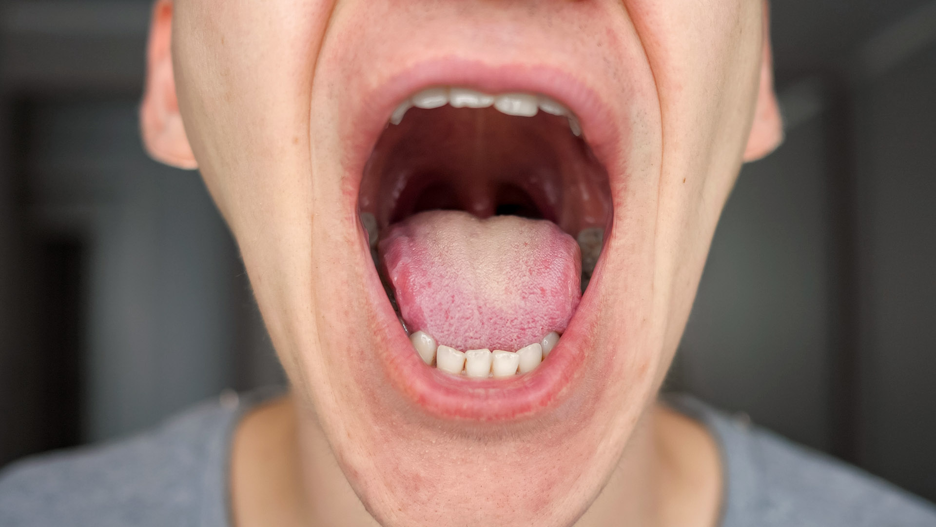 χρώμα γλώσσας