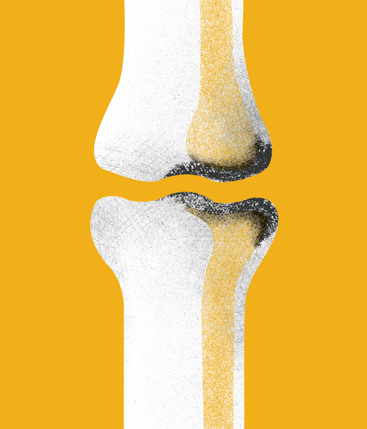 σιωπηλές ασθένειες