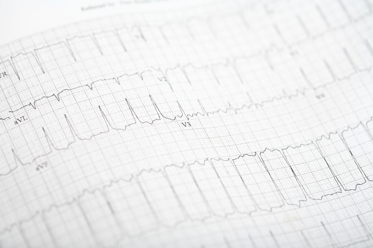 Τι πρέπει να προσέχεις αν ζεις με κολπική μαρμαρυγή