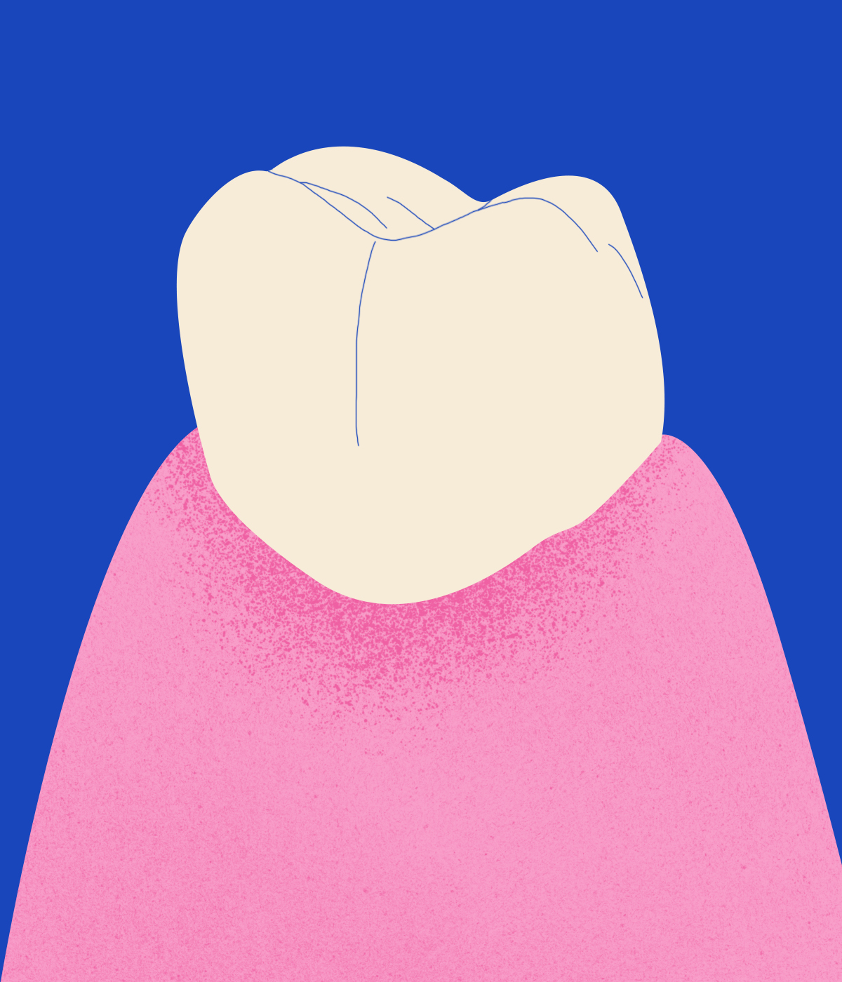 Φρονιμίτες