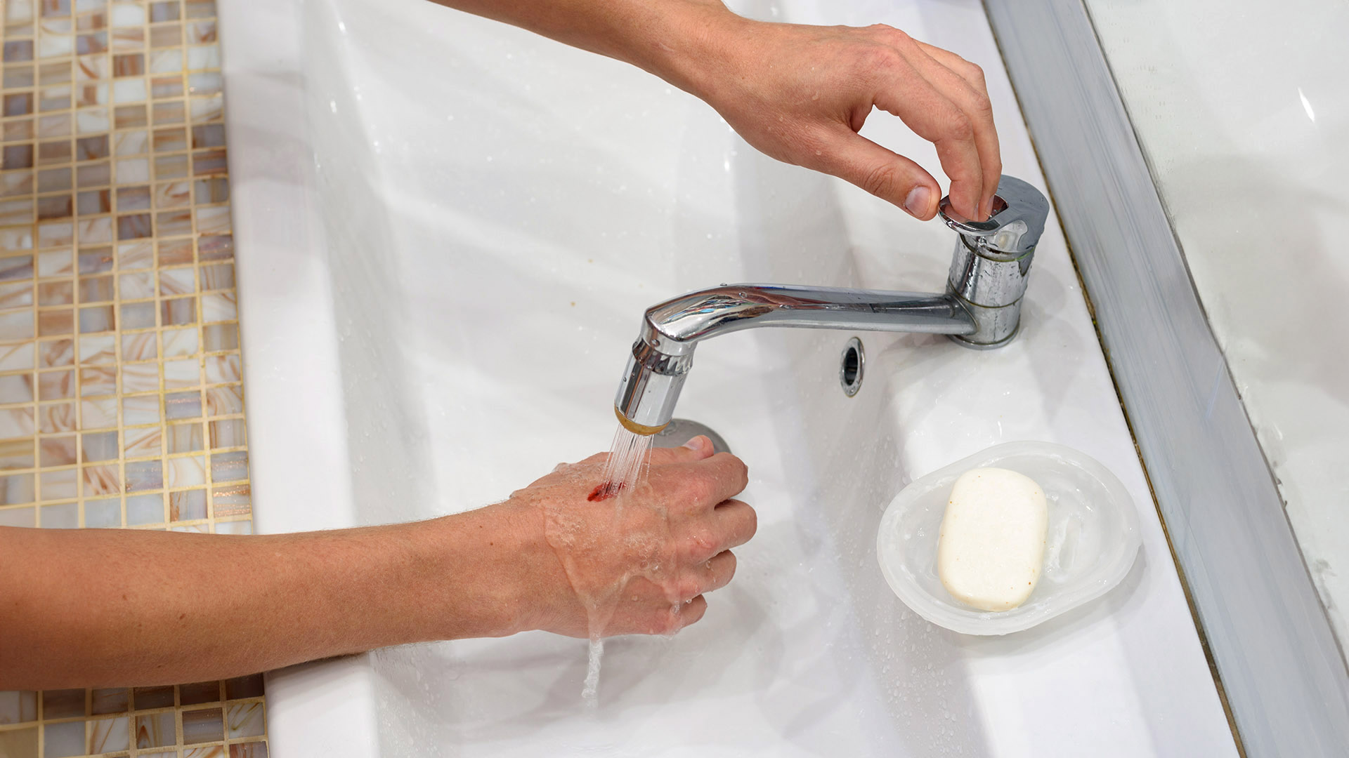 πληγές καθαρισμός