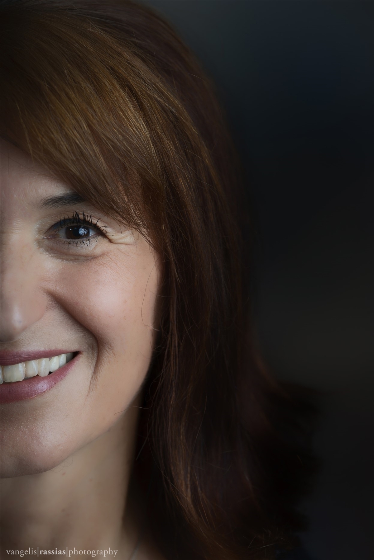 Η Ελισάβετ με τη μαστεκτομή έλυσε όλα της τα προβλήματα