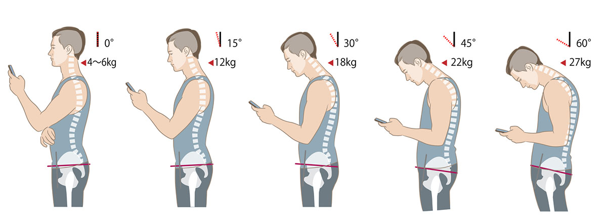 Πόνος στον αυχένα