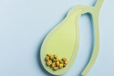 4 ενδείξεις ότι έχεις πέτρα στη χολή