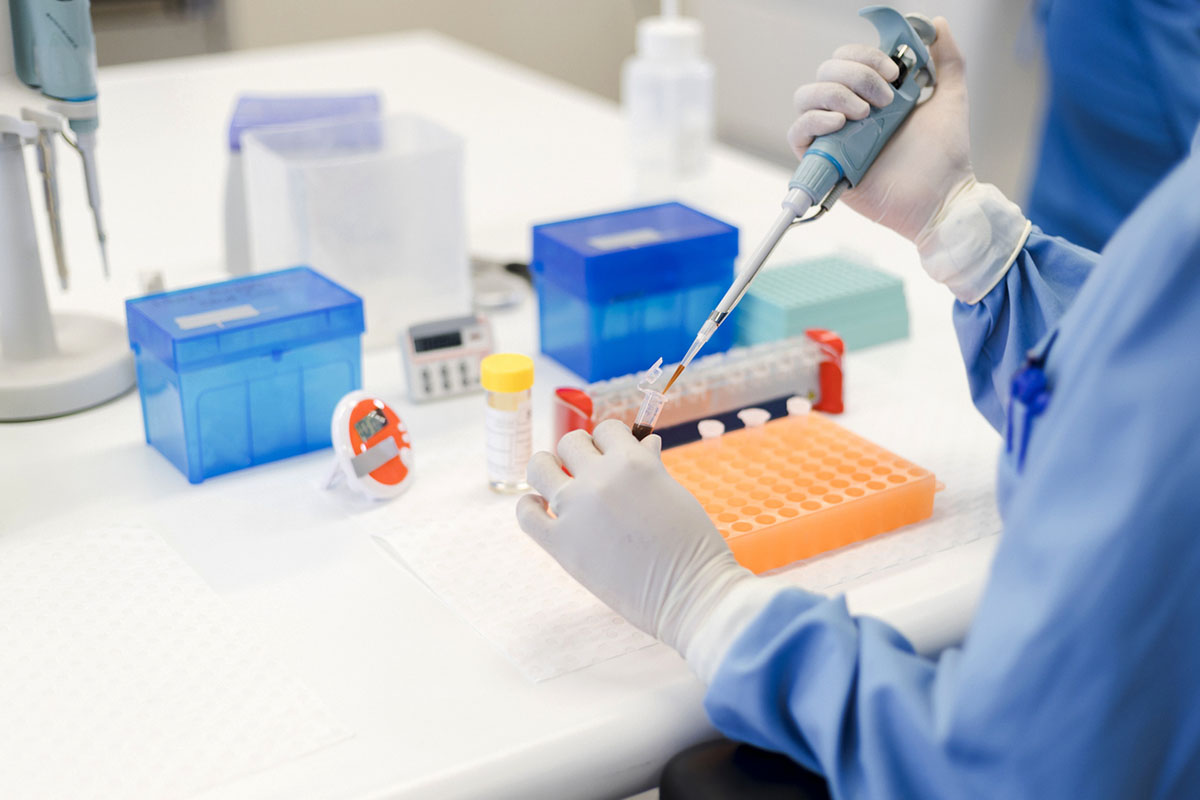 Εξέταση αίματος για Αλτσχάιμερ