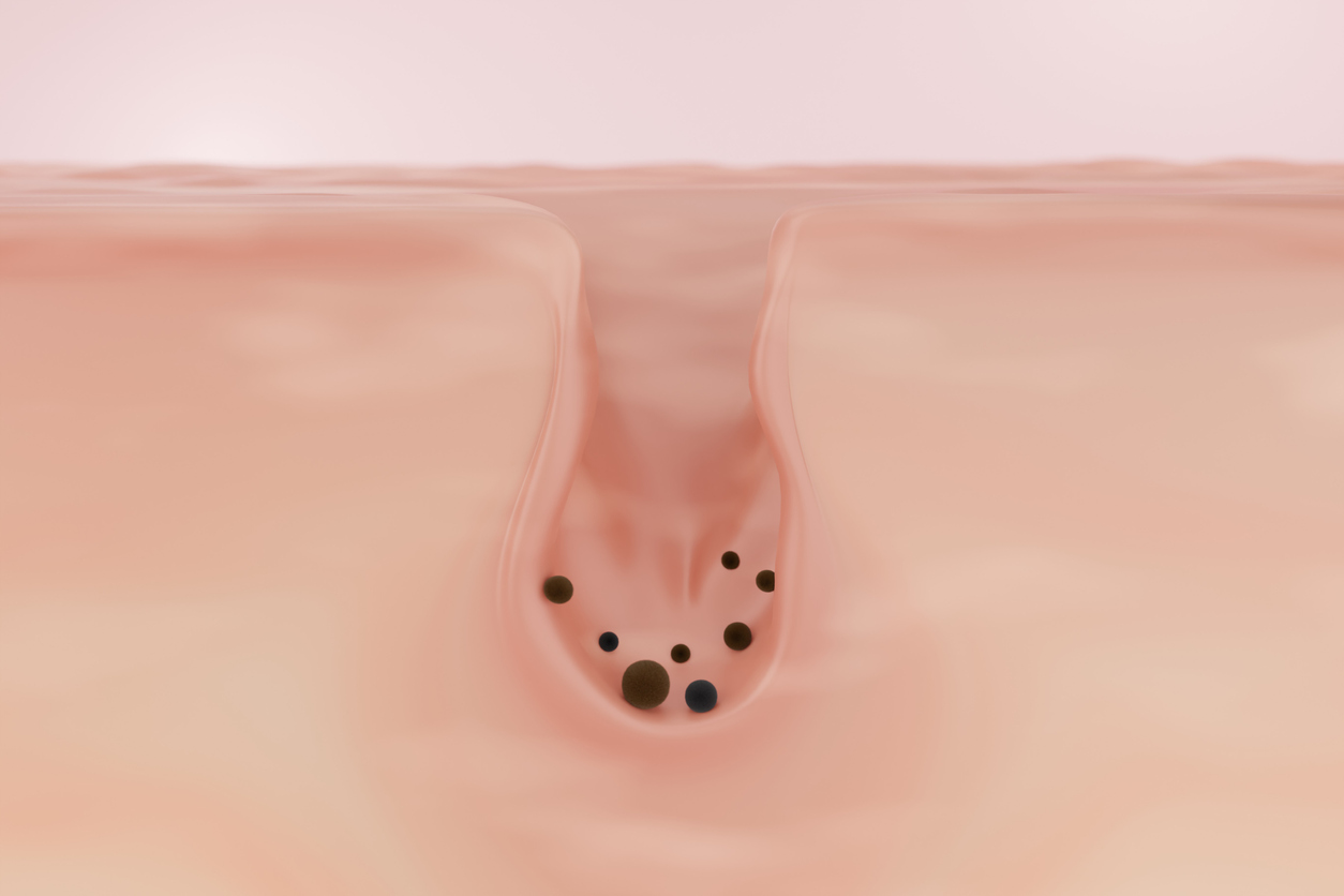 διεσταλμένοι πόροι