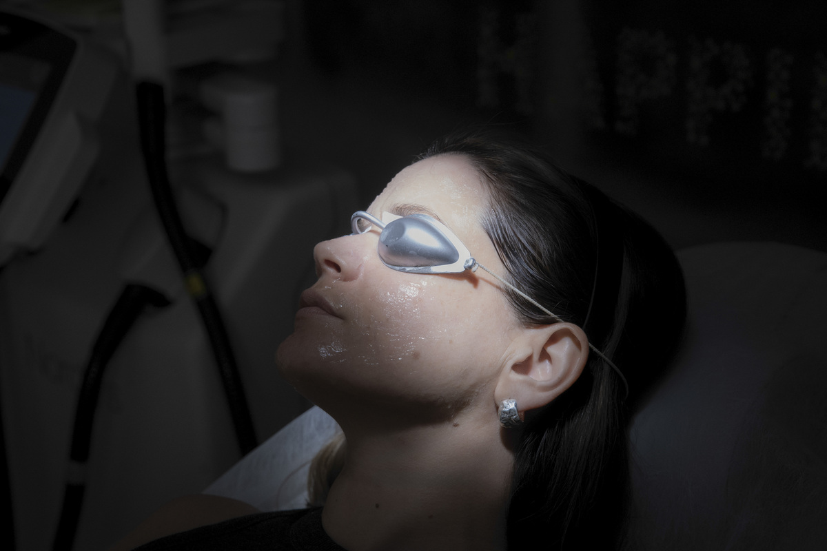 φωτοανάπλαση