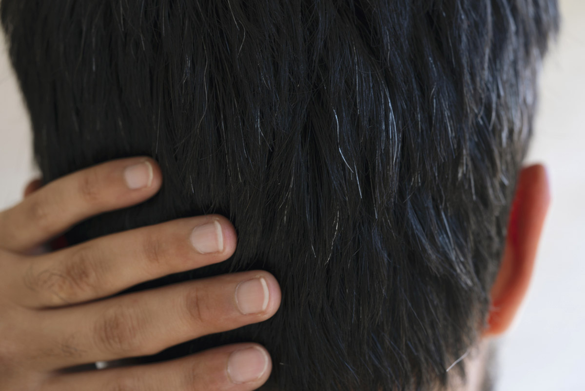 Τι μπορεί να δείχνει το πρόωρο γκριζάρισμα για την υγεία σου