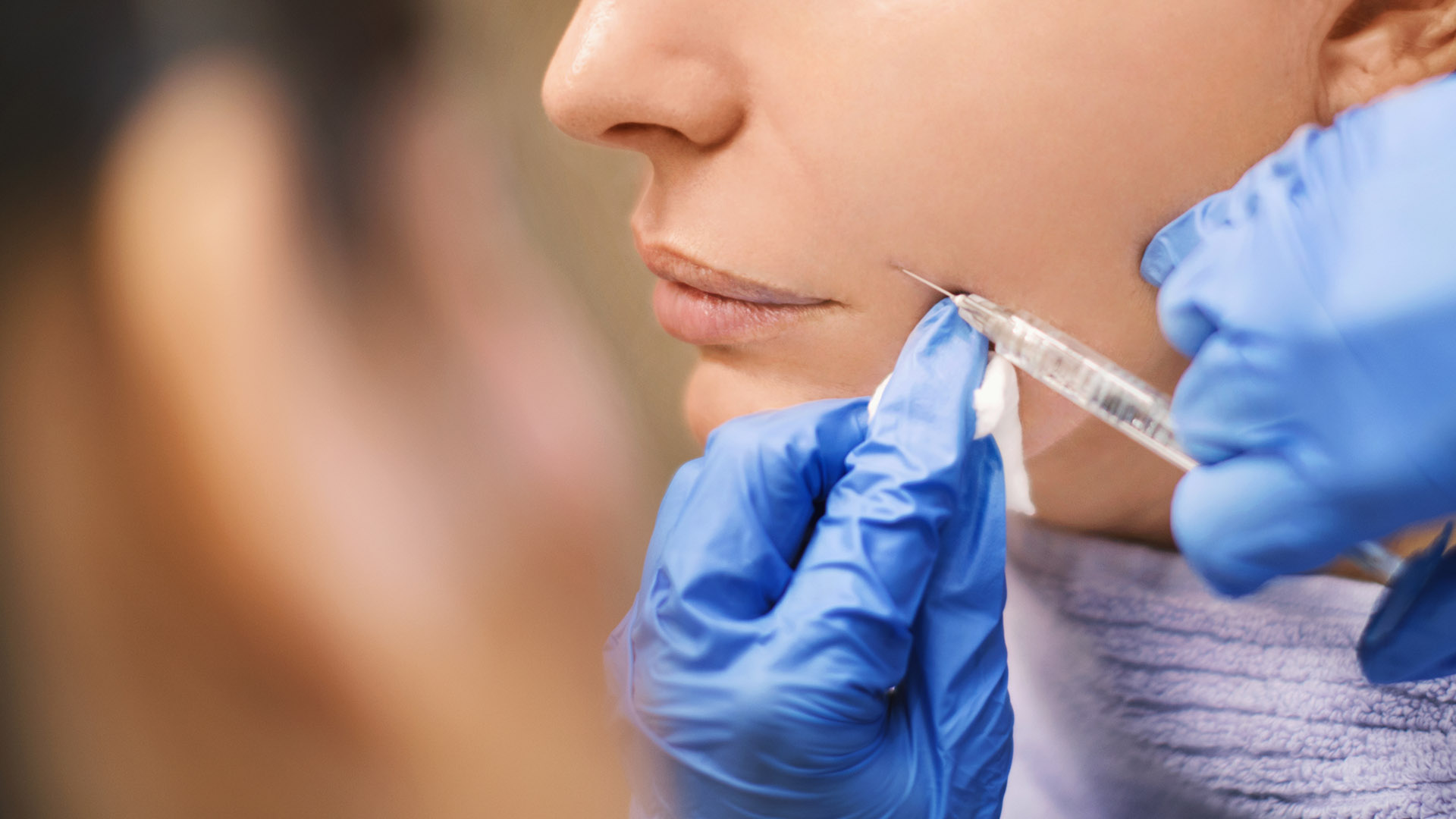 fillers με υαλουρονικό οξύ