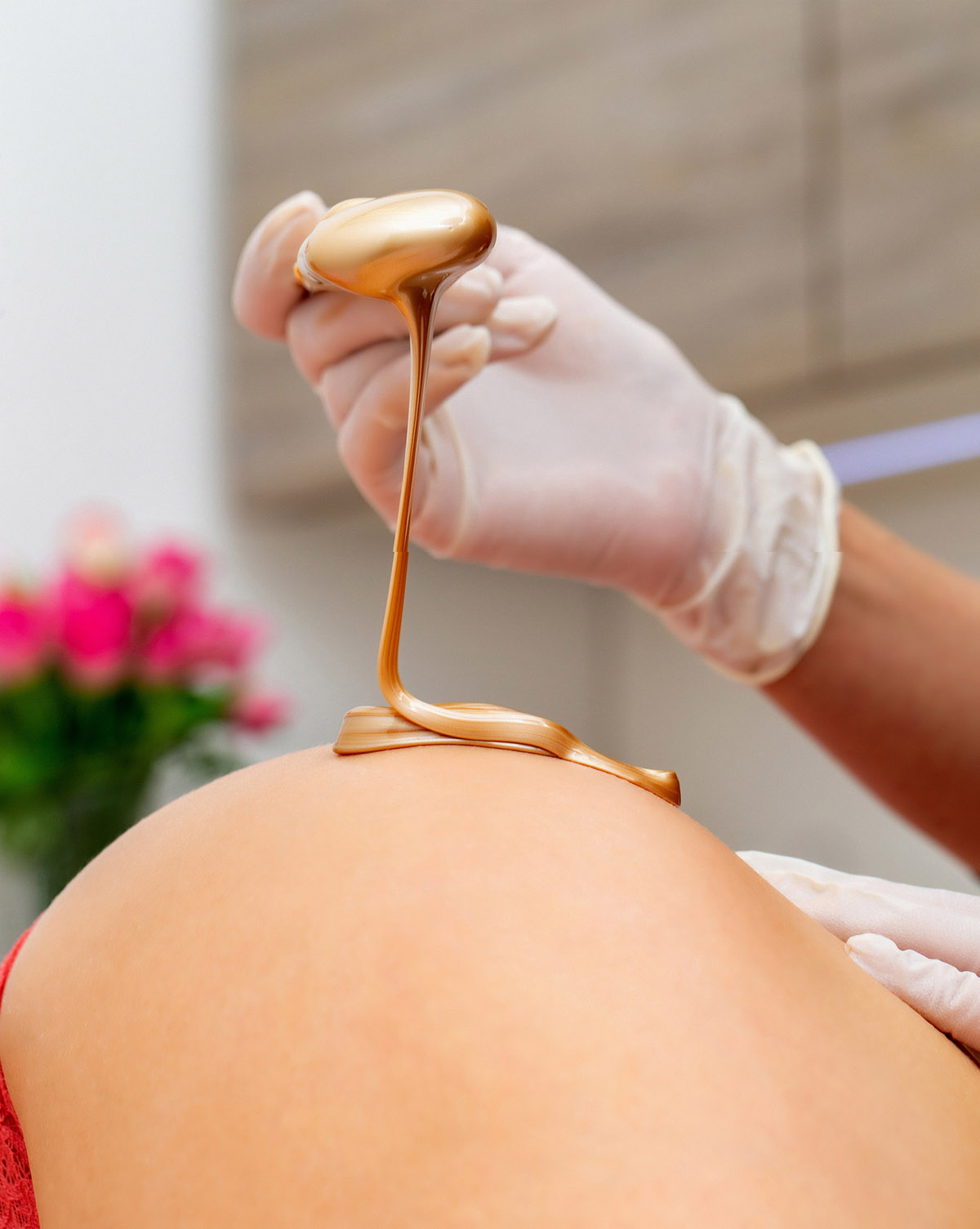 αποτρίχωση στα οπίσθια