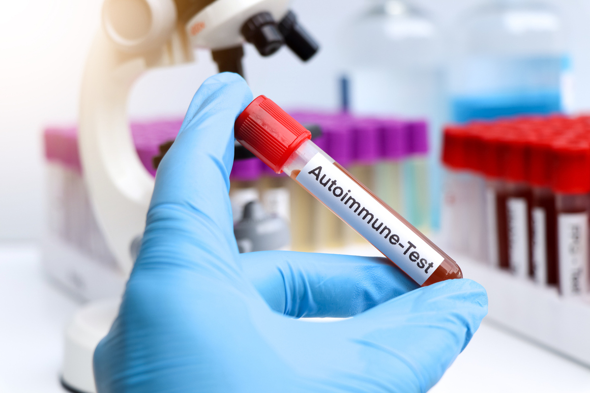 Η Χασιμότο πάει «πακέτο» με άλλα αυτοάνοσα