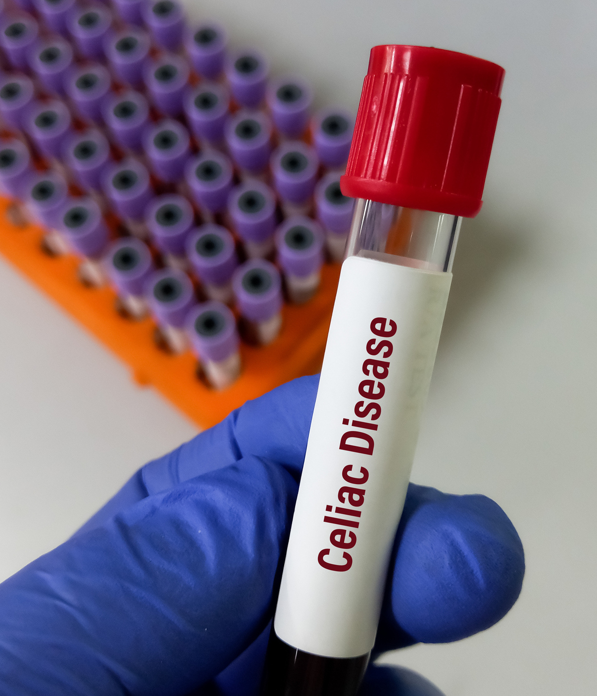 Κοιλιοκάκη και φεριτίνη