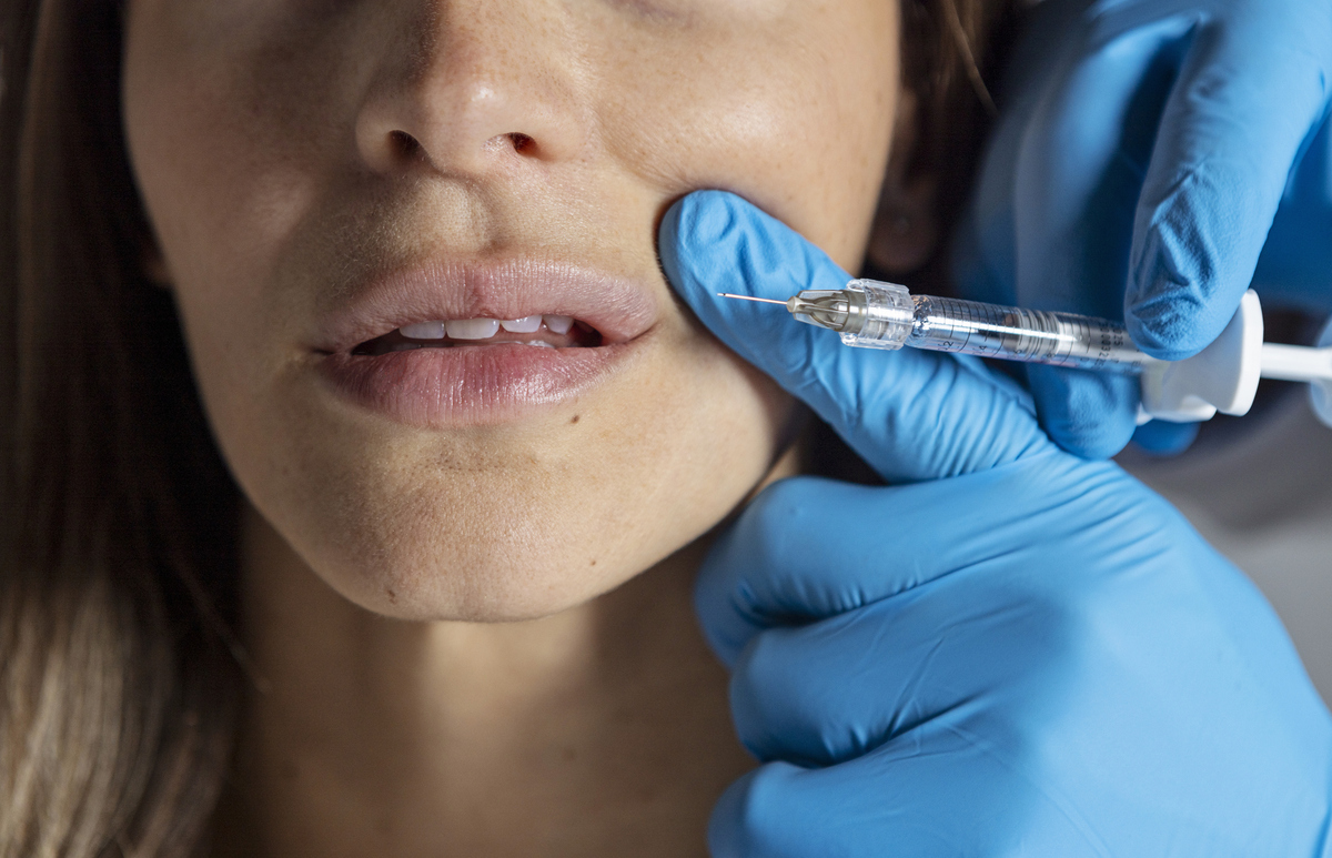 barcode, ρυτίδες του καπνιστή