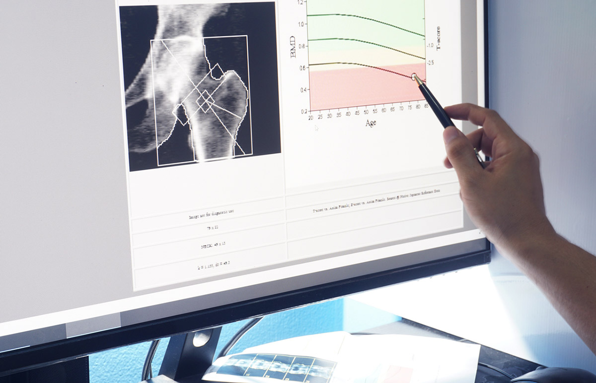 4 άγνωστα οφέλη στο να καταναλώνεις φυτικές ίνες 