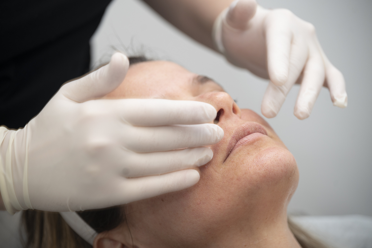 καθαρισμός προσώπου ιατρείο