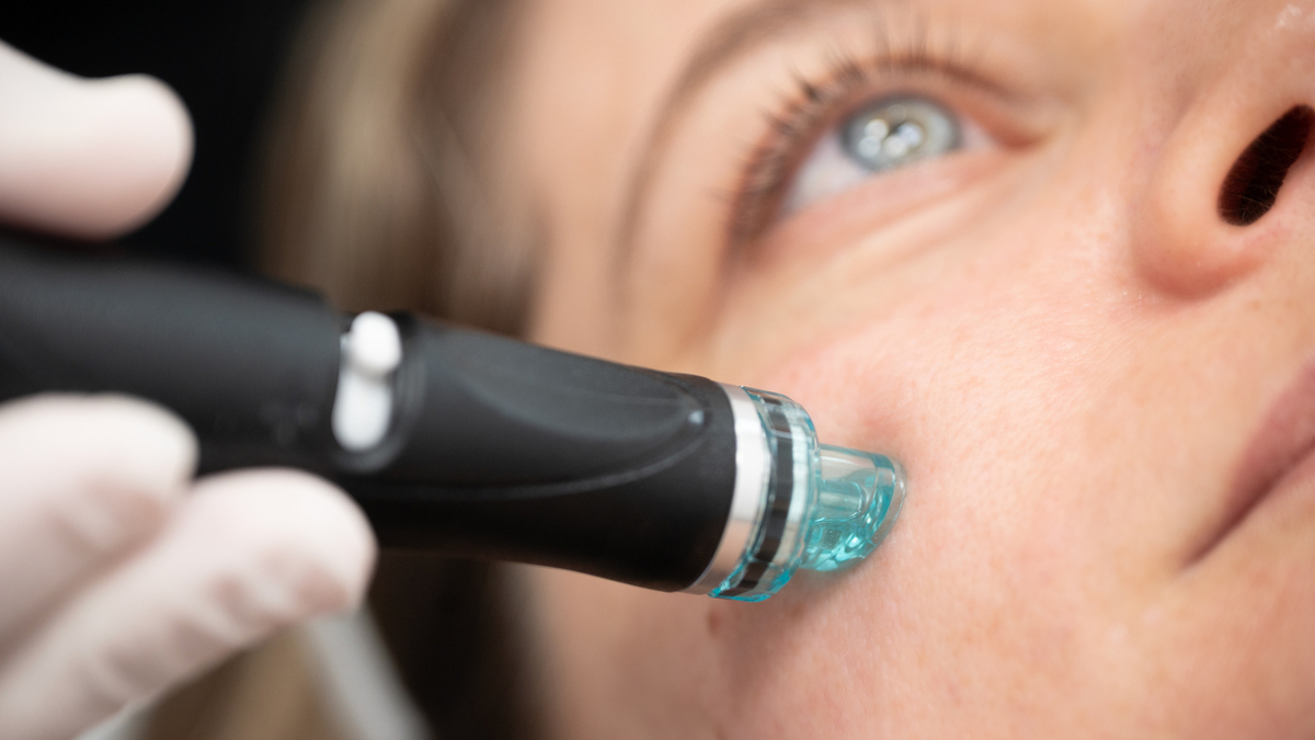 καθαρισμός προσώπου ιατρείο