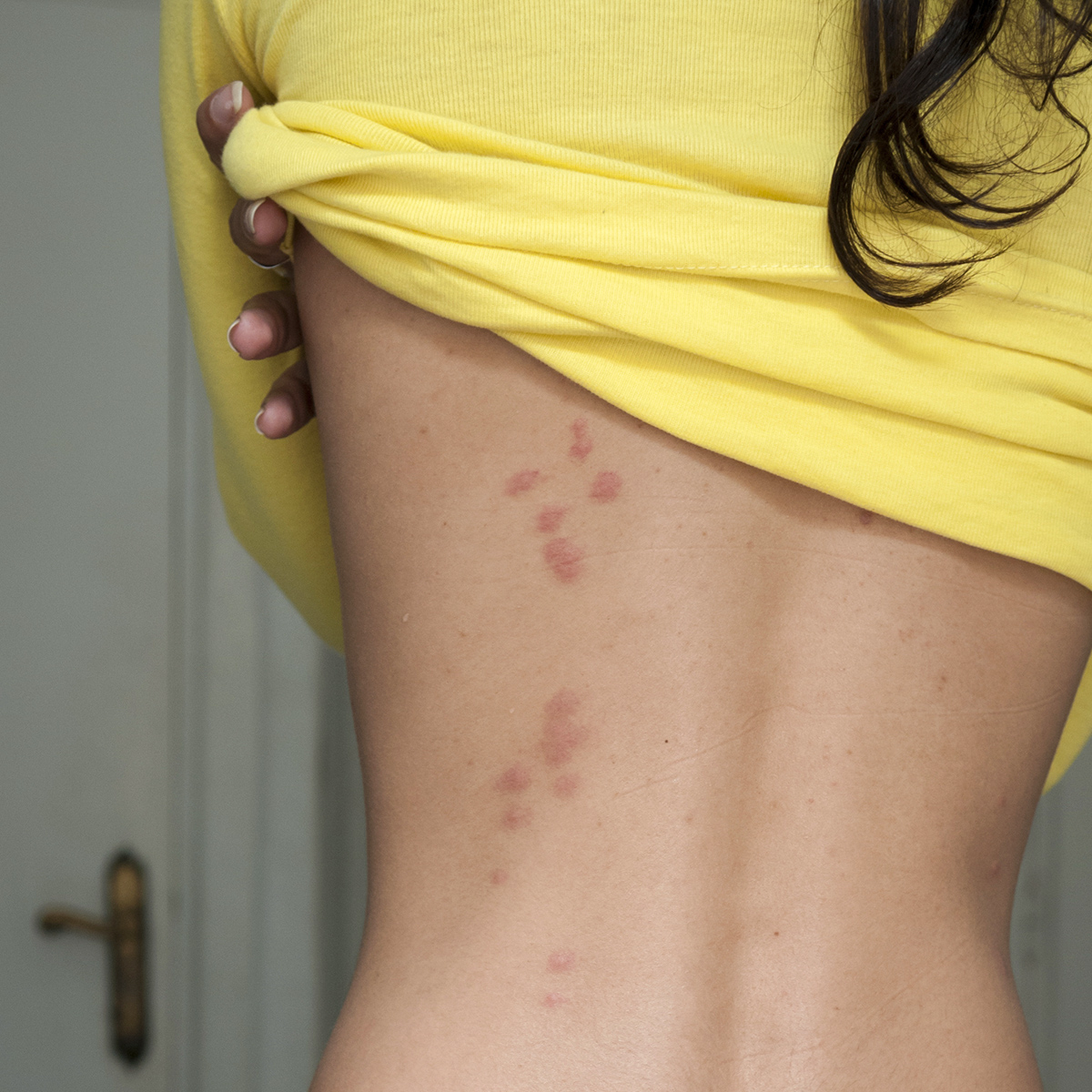 Πώς αποφεύγει μία εντομολόγος τους κοριούς όταν ταξιδεύει