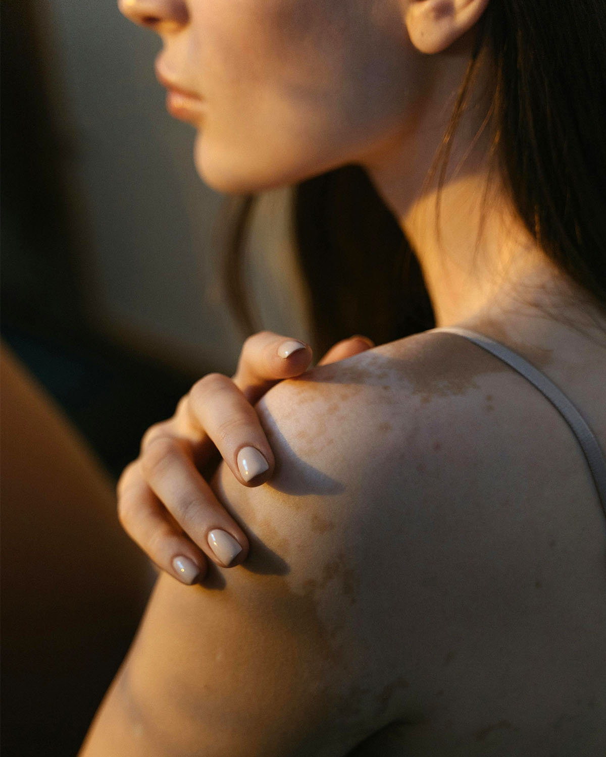 Λεύκη και ήλιος