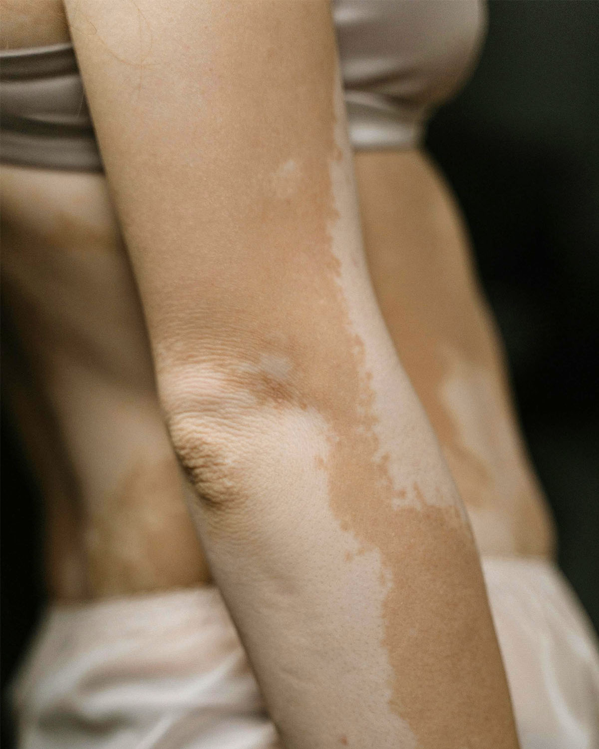 Λεύκη και ήλιος