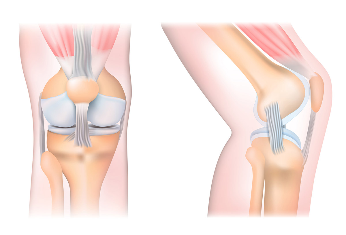 Γιατί πονάνε τόσο πολύ τα γόνατά σου