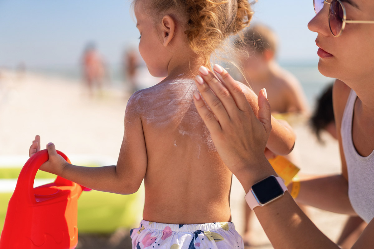 Ηλιακό έγκαυμα