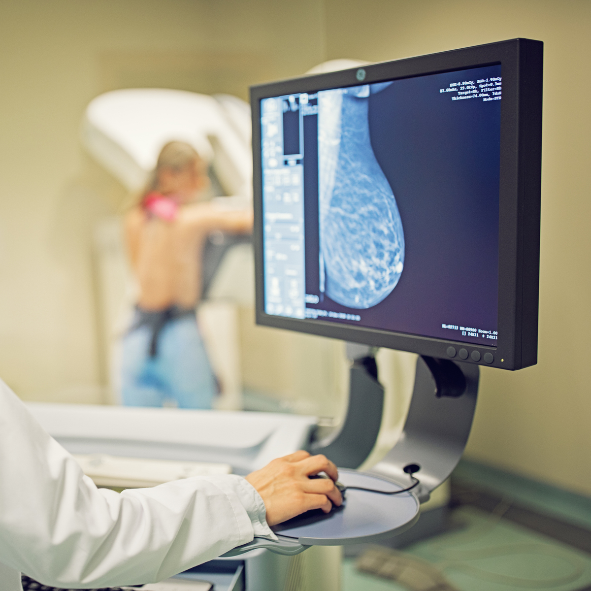 πυκνότητα μαστού