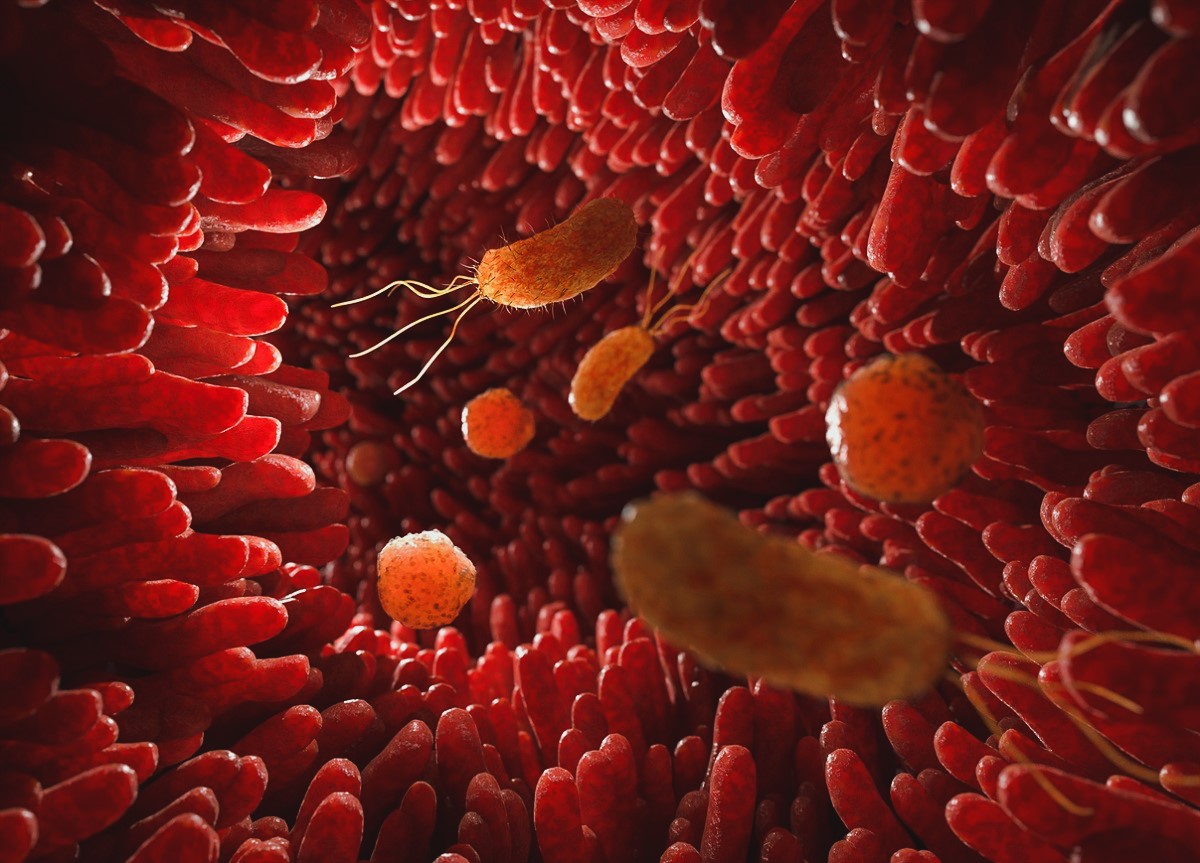 Σύνδρομο Ευερέθιστου Εντέρου