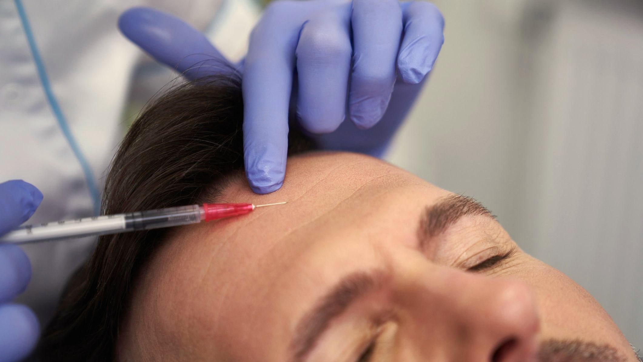 βιοδιεγέρτες κολλαγόνου