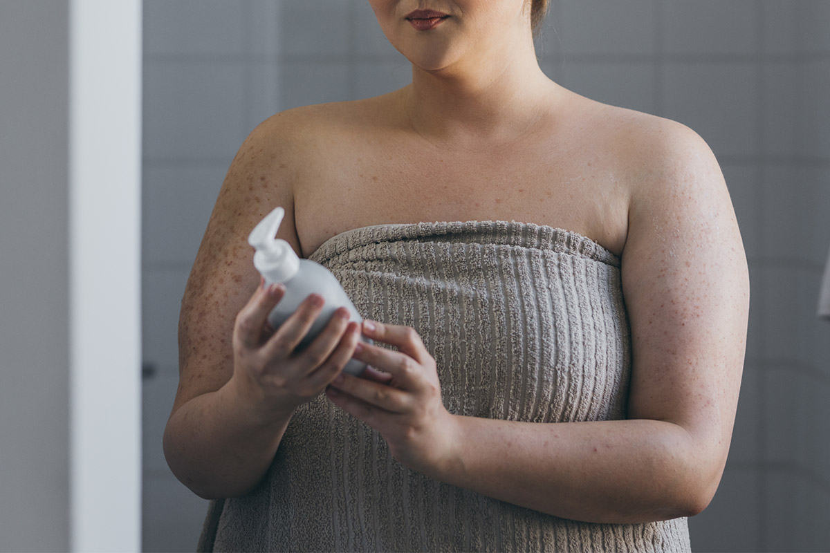 δερματικά προβλήματα