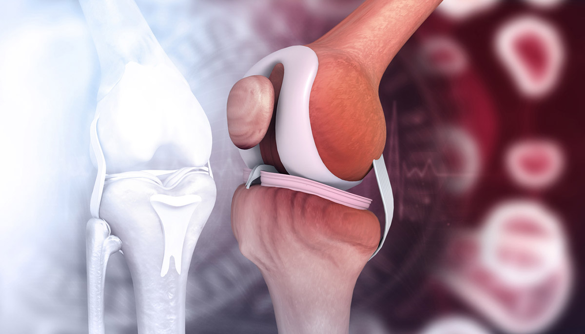 Save the Meniscus: Πώς θα προστατεύσεις τους μηνίσκους σου πριν να είναι αργά