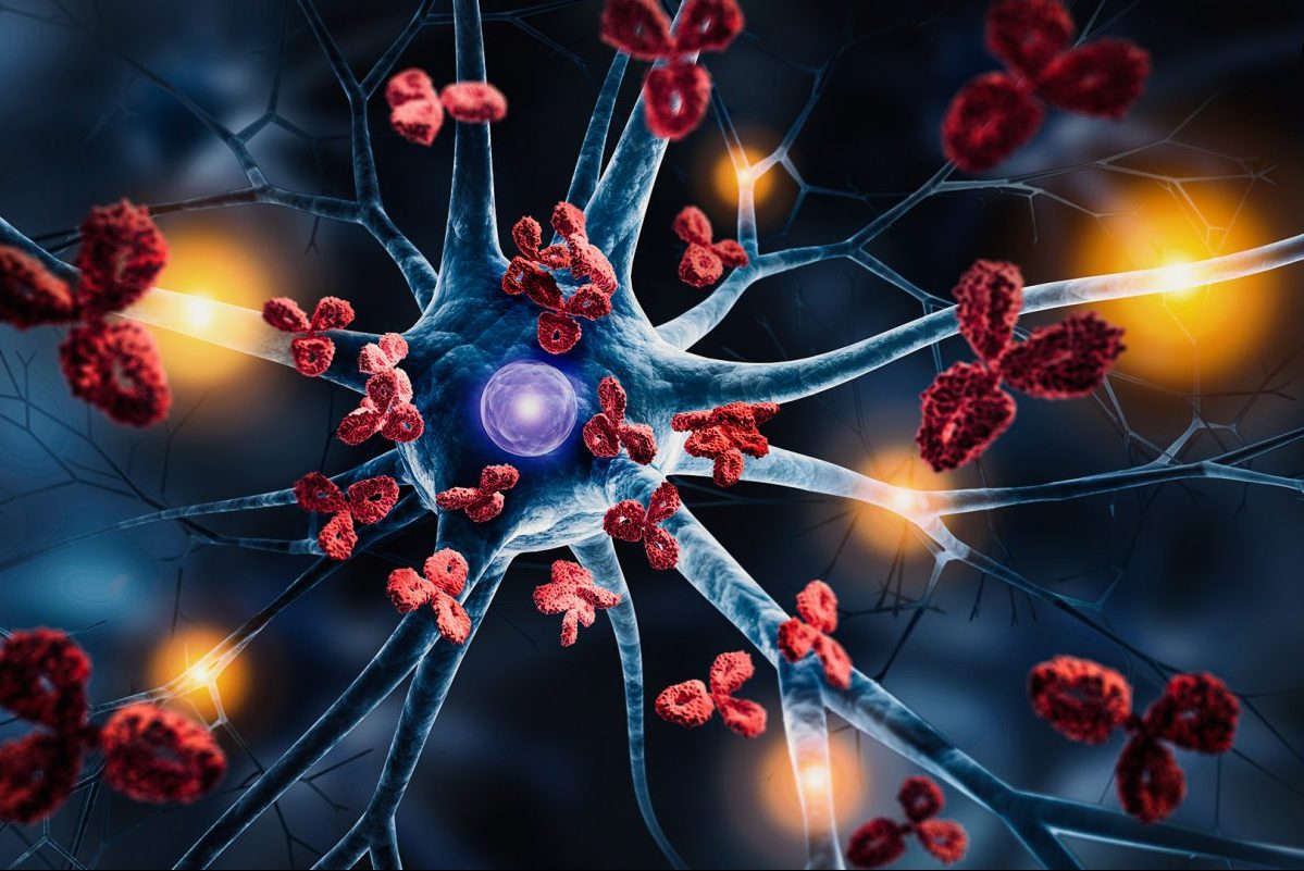 Έχεις αυτοάνοσο;