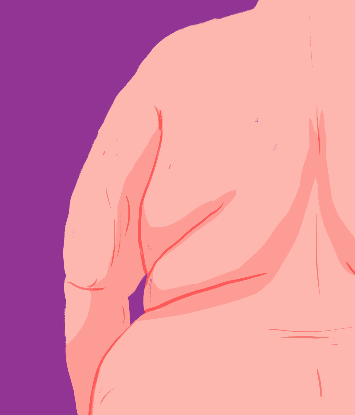 παχυσαρκία