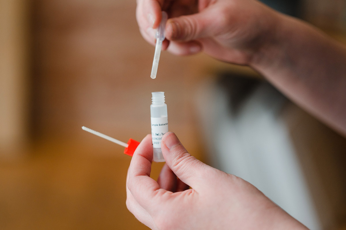 Υψηλά επίπεδα κορτιζόλης